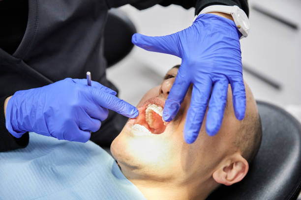 Best Emergency Dental Care for Abscessed Tooth in Lexington, OK
