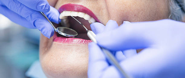 Best Emergency Dental Extractions in Lexington, OK